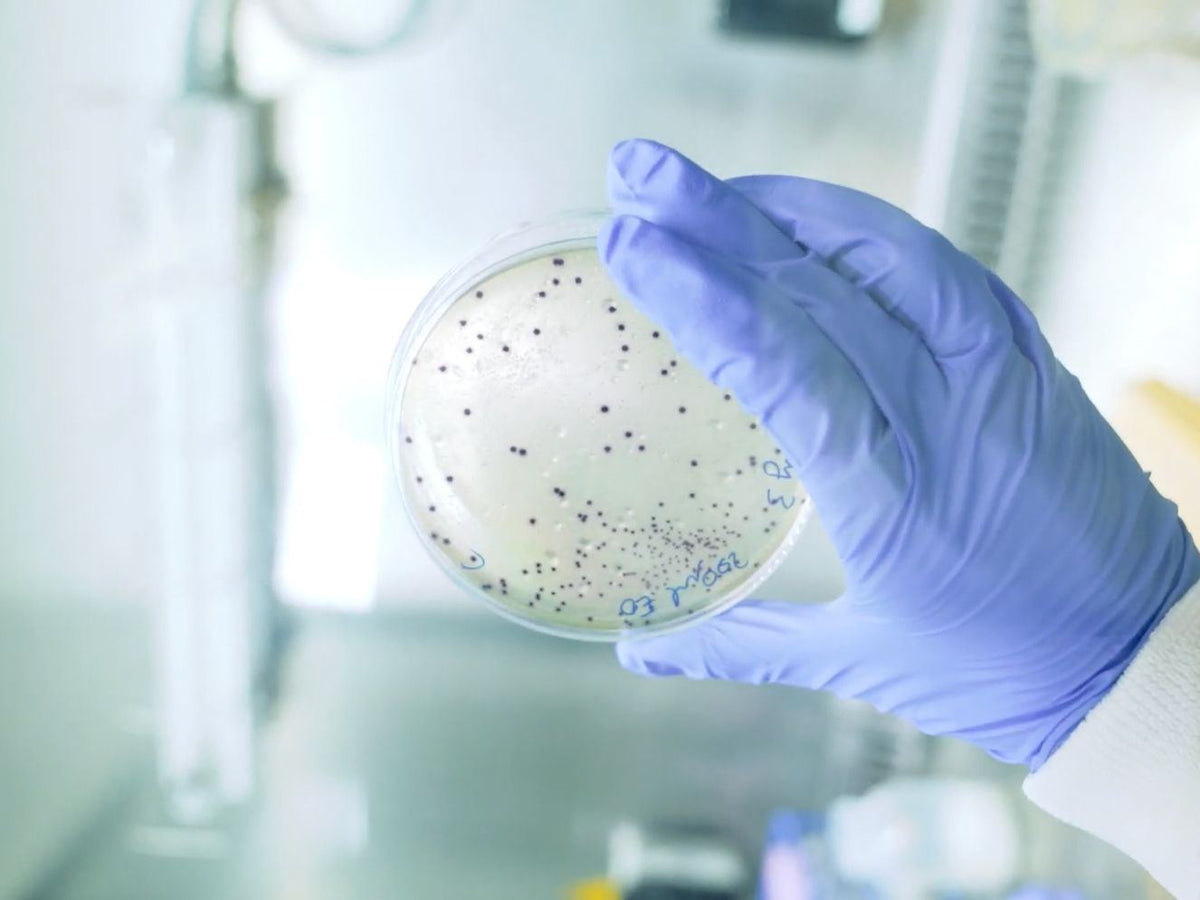 A gloved hand holding a Petri dish of bacterial colonies